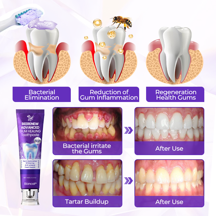 Biancat® BeeRenew Advanced Gum Healing Toothpaste⭐