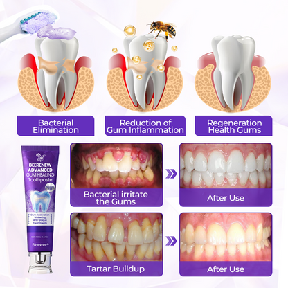 Biancat® BeeRenew Advanced Gum Healing Toothpaste⭐