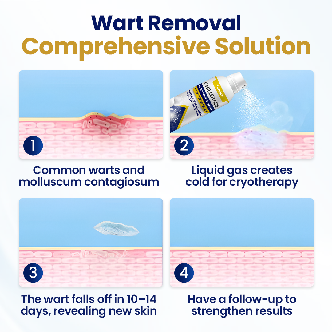 Timilk® ChillErase Bump Renewal Spray⭐