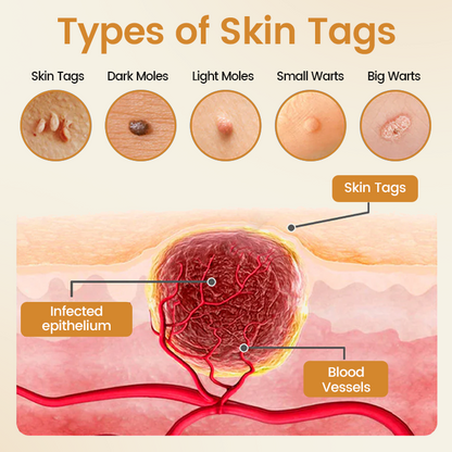 Timilk® BeeVenom Wart Renewal Spray