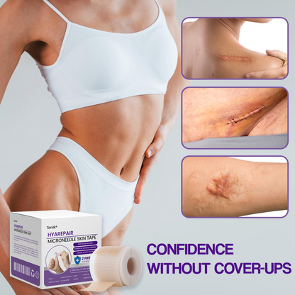 Timilk® HyaRepair Microneedle Skin Tape⭐