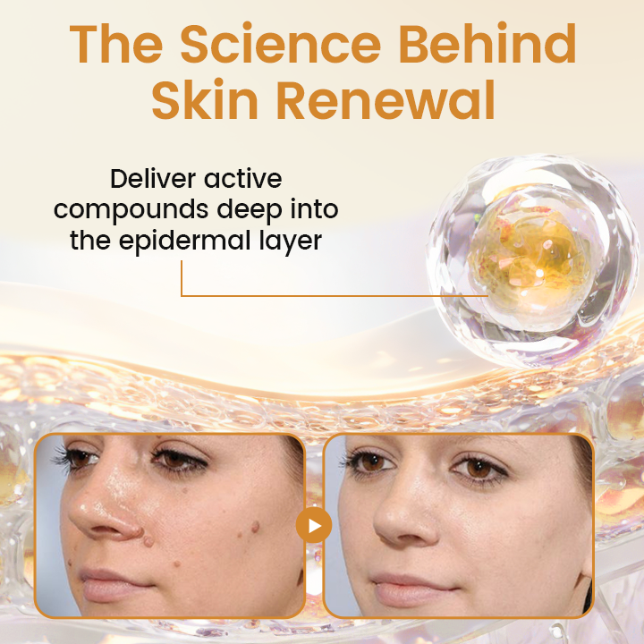 Timilk® BeeVenom Wart Renewal Spray