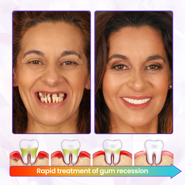 Biancat® BeeRenew Advanced Gum Healing Toothpaste⭐