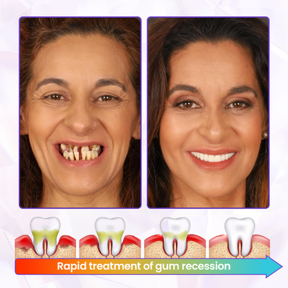 Biancat® BeeRenew Advanced Gum Healing Toothpaste⭐