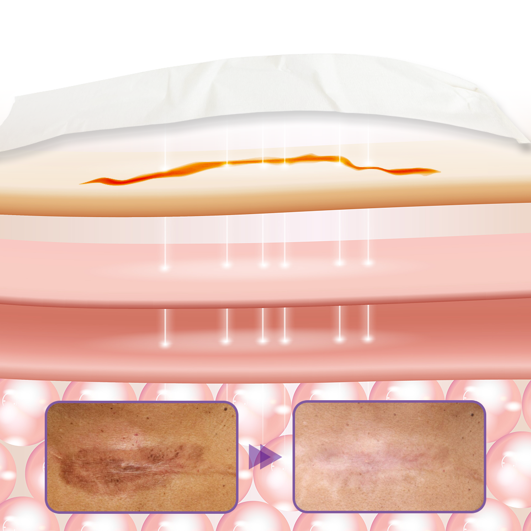 Timilk® HyaRepair Microneedle Skin Tape⭐