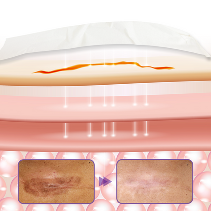 Timilk® HyaRepair Microneedle Skin Tape⭐